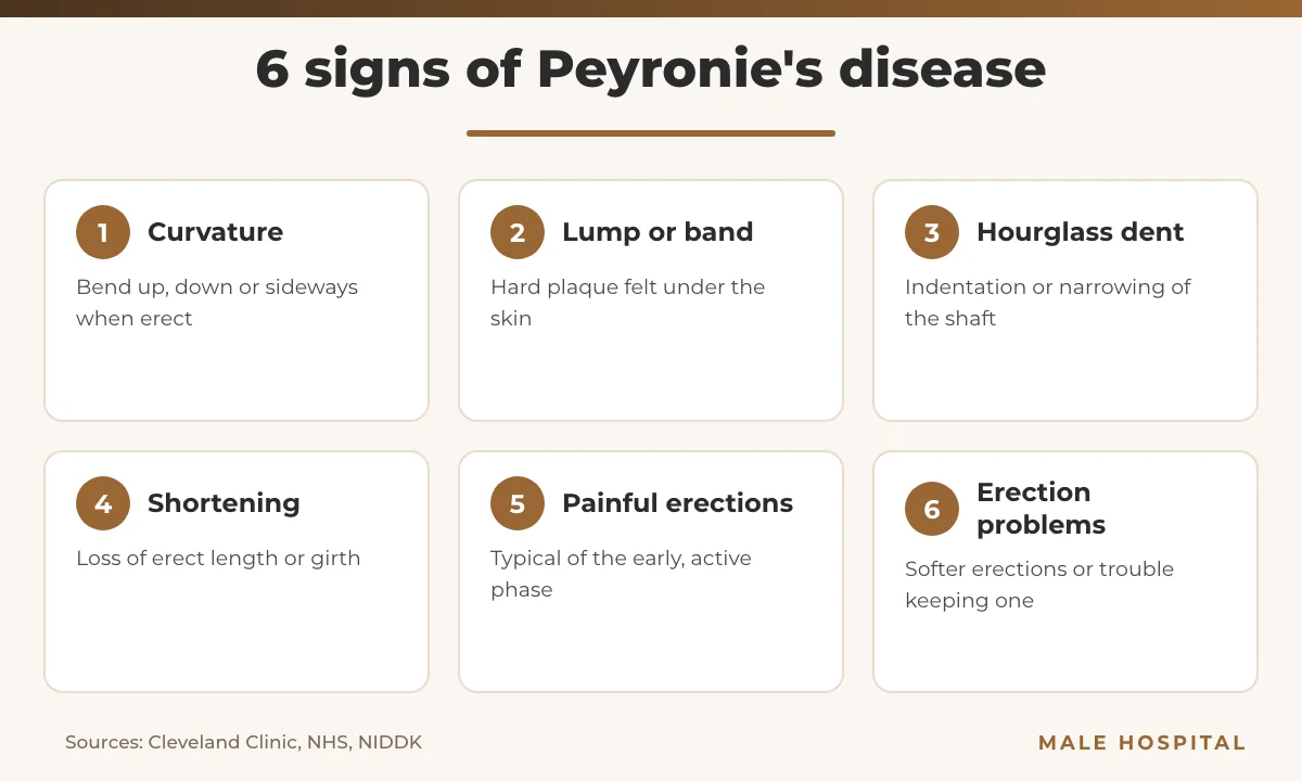 Infographic of six Peyronie's disease symptoms: curvature, lump, hourglass dent, shortening, painful erections and erectile dysfunction