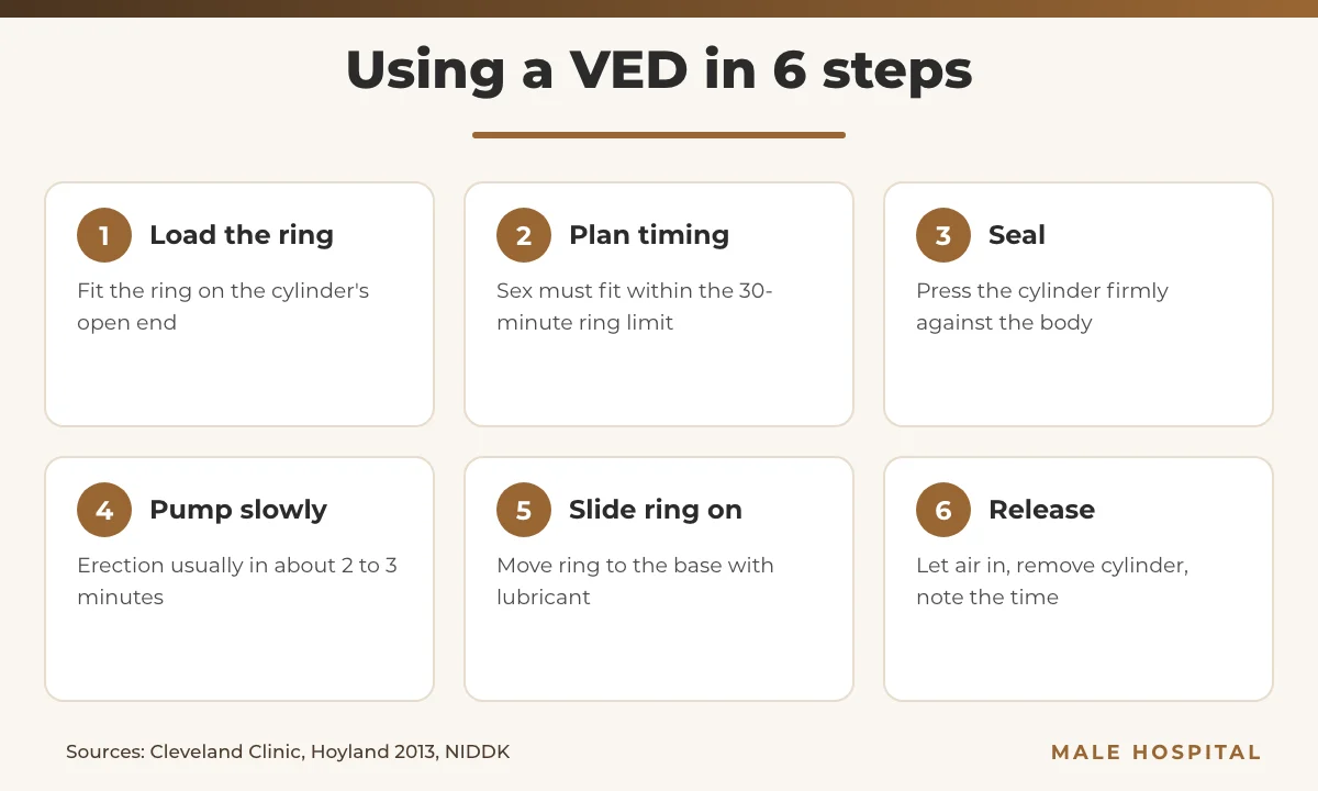 Infographic of the six steps to use a vacuum erection device safely