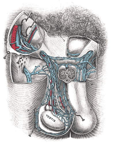 Anatomical drawing of the spermatic veins and pampiniform plexus, the veins that widen in a varicocele