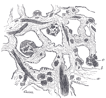 Microscopic section of corpus cavernosum erectile tissue, relevant to venous leak erectile dysfunction